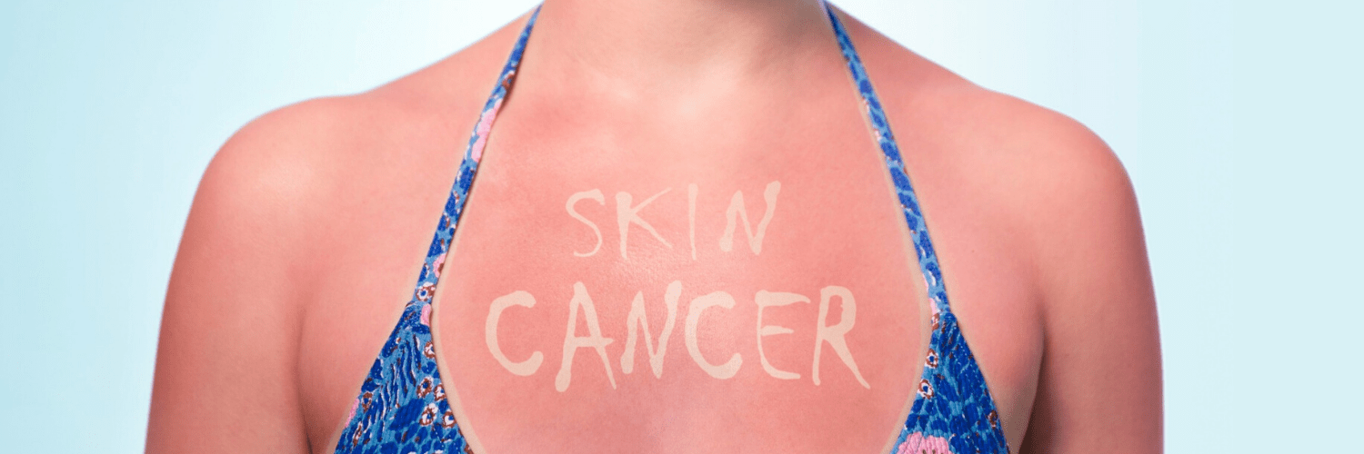 Other Skin Cancers